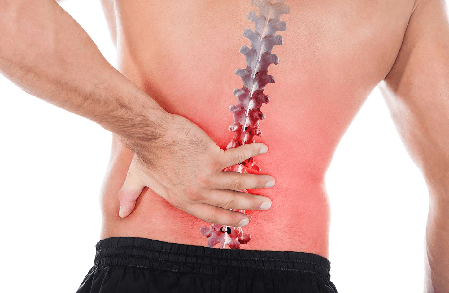 Herniated Disc