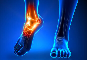 Ankle and Foot Pain