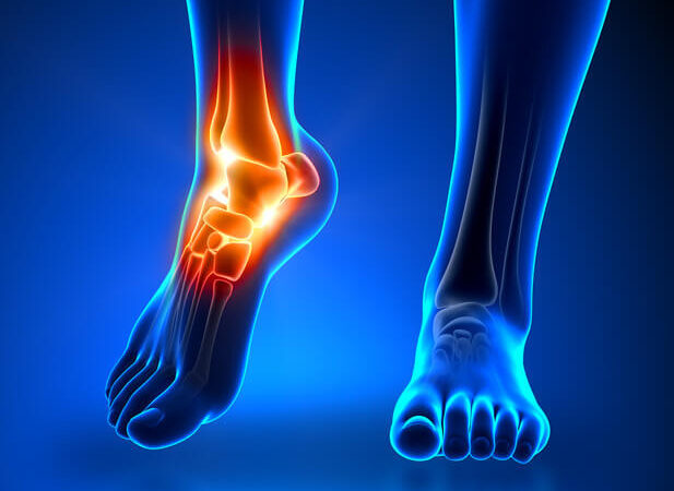 Ankle and Foot Pain