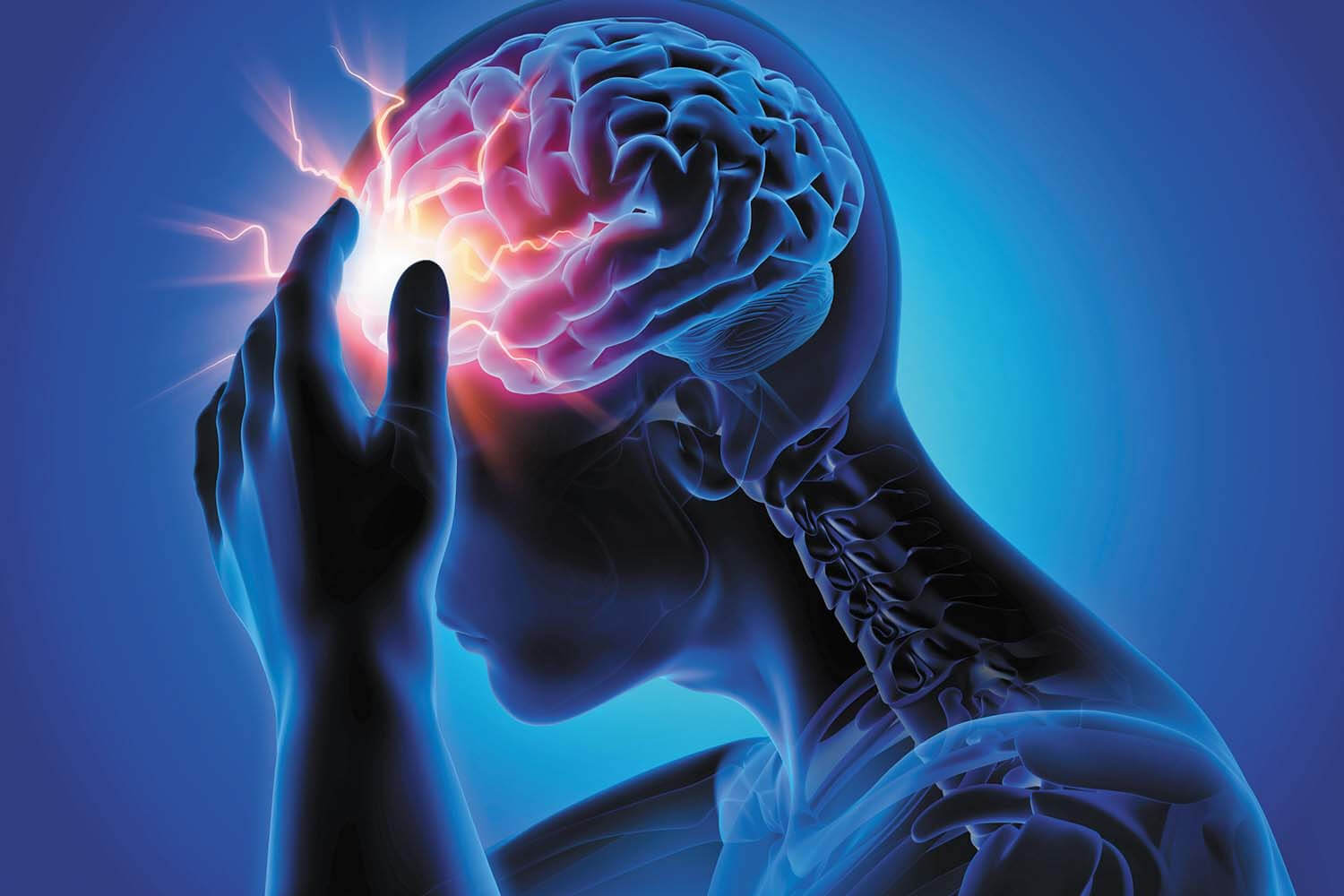 headache Headache