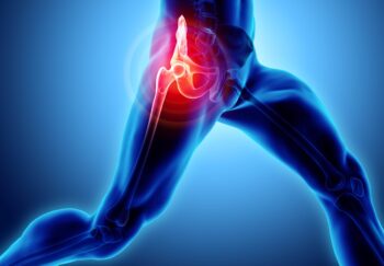 Labral Injuries