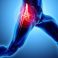 Labral Injuries