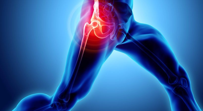 Labral Injuries