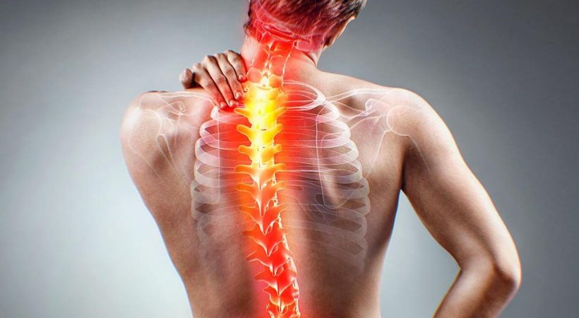 Nerve Pain