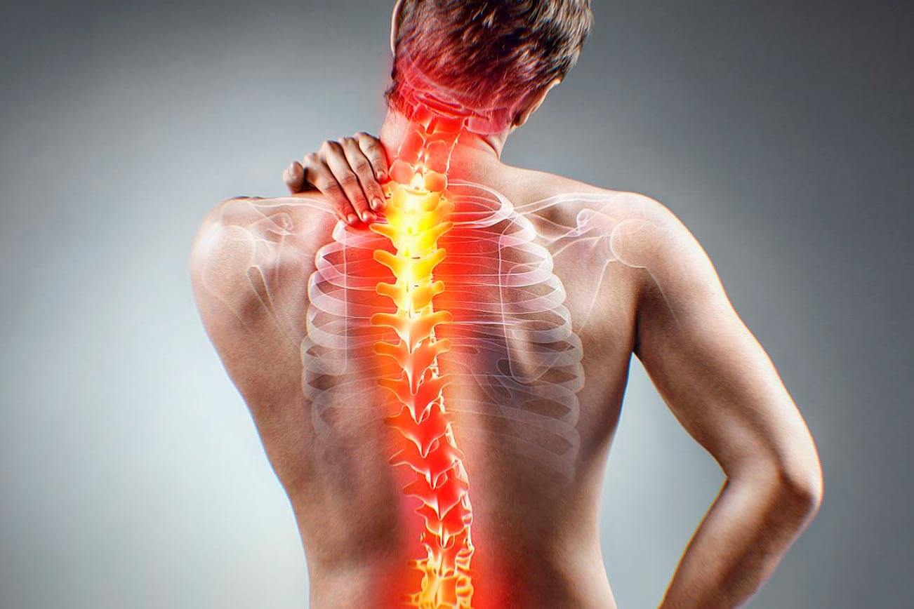 Nerve Pain