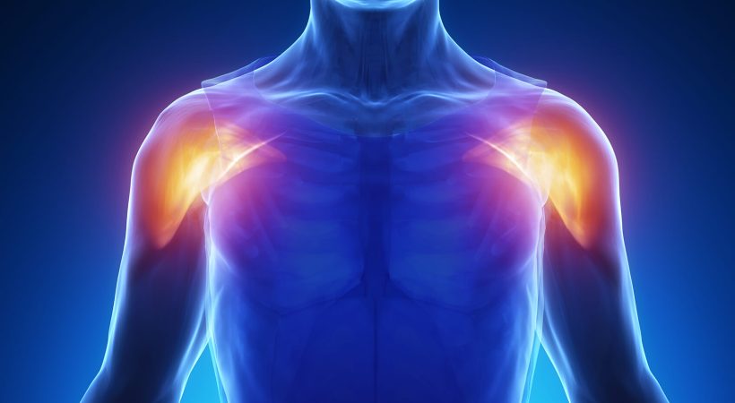 Shoulder Pain