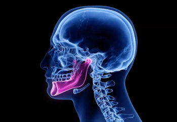 Temporomandibular Joint Dysfunction