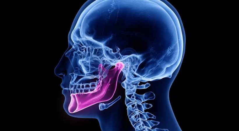 Temporomandibular Joint Dysfunction