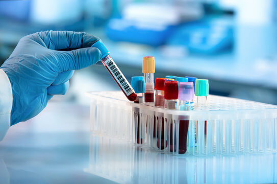 lab-tests ESTABLISHING YOUR BASELINE
