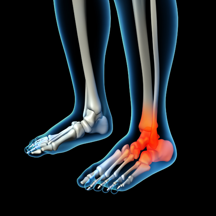 Ankle and Foot Pain 2 Ankle and Foot Pain 2