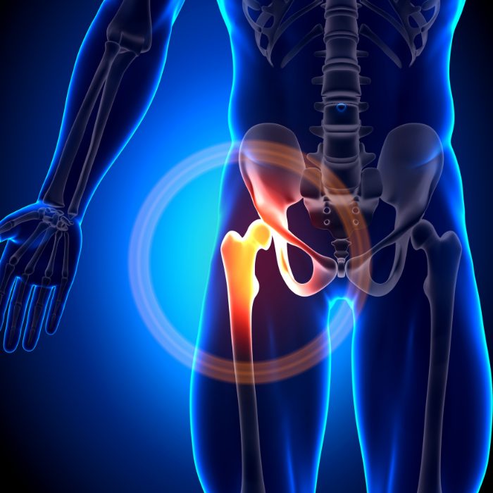 Hip and Sacroiliac Joint Pain 2 Hip and Sacroiliac Joint Pain 2