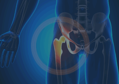 Hip and Sacroiliac Joint Pain