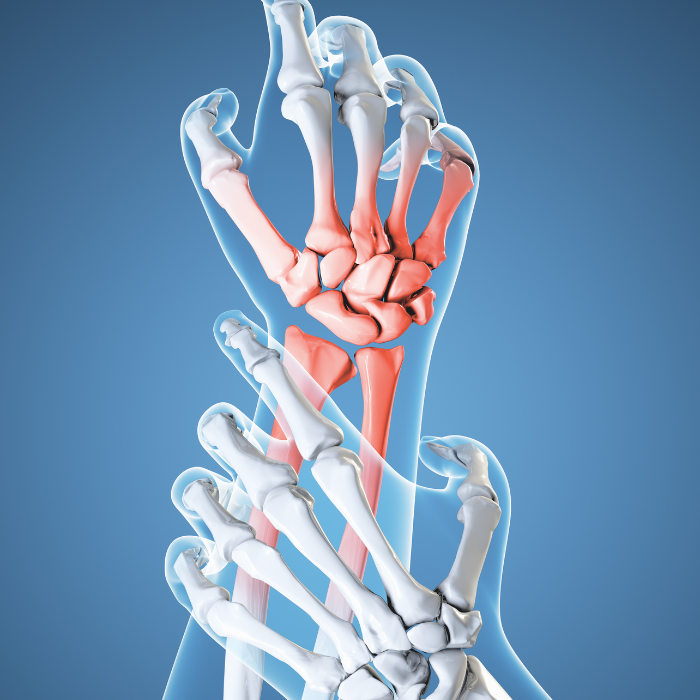 Hand and Wrist Pain 2 Hand and Wrist Pain 2