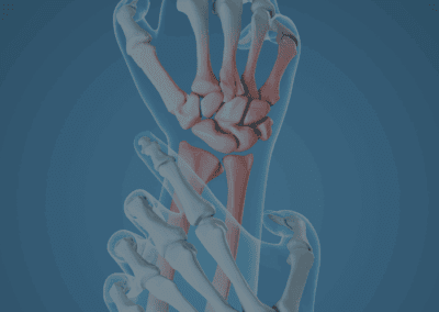 Hand and Wrist Pain