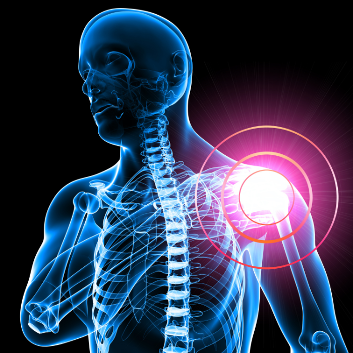 Shoulder Pain 2 Shoulder Pain 2