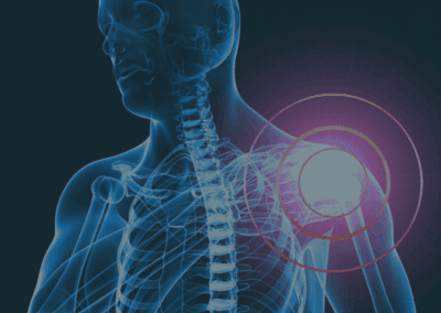 Shoulder Pain