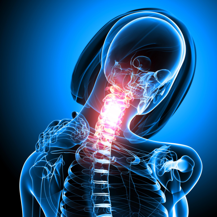 Neck Pain 2 Neck Pain 2