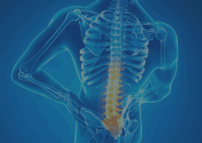 Lower Back Pain