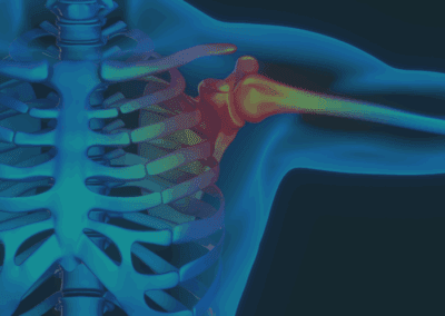 Rotator Cuff Injuries