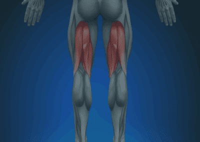 Tendinopathy